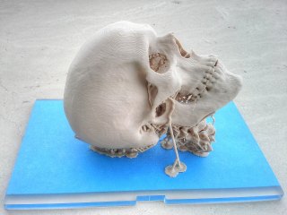 destekli-3d-baski-kafatasi-modeli.jpg